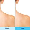imageDifferin Acne Body Spray Acne Treatment with Salicylic Acid by the makers of Differin Gel 360 Formula for Back Acne Chest and Shoulders 6 oz