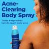 imageDifferin Acne Body Spray Acne Treatment with Salicylic Acid by the makers of Differin Gel 360 Formula for Back Acne Chest and Shoulders 6 oz