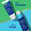 imageDifferin Acne Body Spray Acne Treatment with Salicylic Acid by the makers of Differin Gel 360 Formula for Back Acne Chest and Shoulders 6 oz