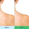 imageDifferin Acne Body Wash by the makers of Differin Gel Acne Treatment Cleanser with Salicylic Acid Cream to Lather Formula for Back Chest Shoulders 10 Oz