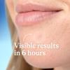 imageDifferin Acne Patches Pimple Patches for Acne Prone Skin Formulated with Salicylic Acid and Centella Fast Triple Action Power Patch for Day ampamp Night Dermatologist Tested 36 Count