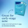 imageDifferin Acne Patches Pimple Patches for Acne Prone Skin Formulated with Salicylic Acid and Centella Fast Triple Action Power Patch for Day ampamp Night Dermatologist Tested 36 Count