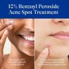 imageDifferin Acne Spot Treatment with 10 Benzoyl Peroxide Maximum Strength OTC Acne Treatment Fast Acting Spot Treatment for Face 1 oz