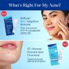 imageDifferin Acne Spot Treatment with 10 Benzoyl Peroxide Maximum Strength OTC Acne Treatment Fast Acting Spot Treatment for Face 1 oz