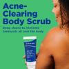imageDifferin Body Scrub with Salicylic Acid Acne Clearing Improves Tone and Texture Prone Skin on Back Shoulders and Chest 8 Oz Packaging May Vary