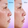 imageDifferin Dark Spot Correcting Face Serum Dark Spot Correcting Serum by the makers of Differin Gel Gentle Skin Care for Acne Prone Sensitive Skin 1 oz Packaging May VaryDark Spot Serum