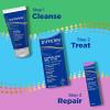 imageDifferin Gel Acne Scar Spot Treatment for Face Resurfacing Scar Gel Gentle Skin Care for Acne Prone Sensitive Skin 1 Oz Packaging May Vary